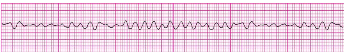 <p>What’s the rhythm?</p>