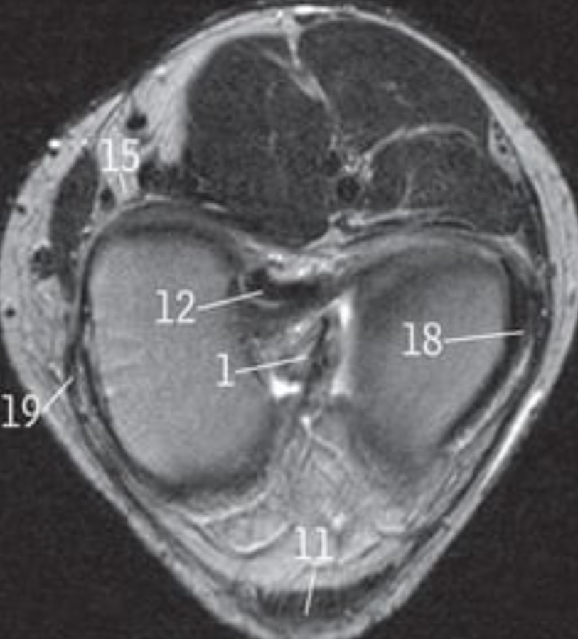 <p>18</p>