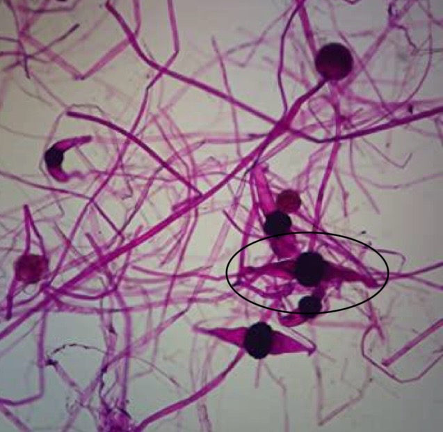 <p>Identify: Fungi</p>