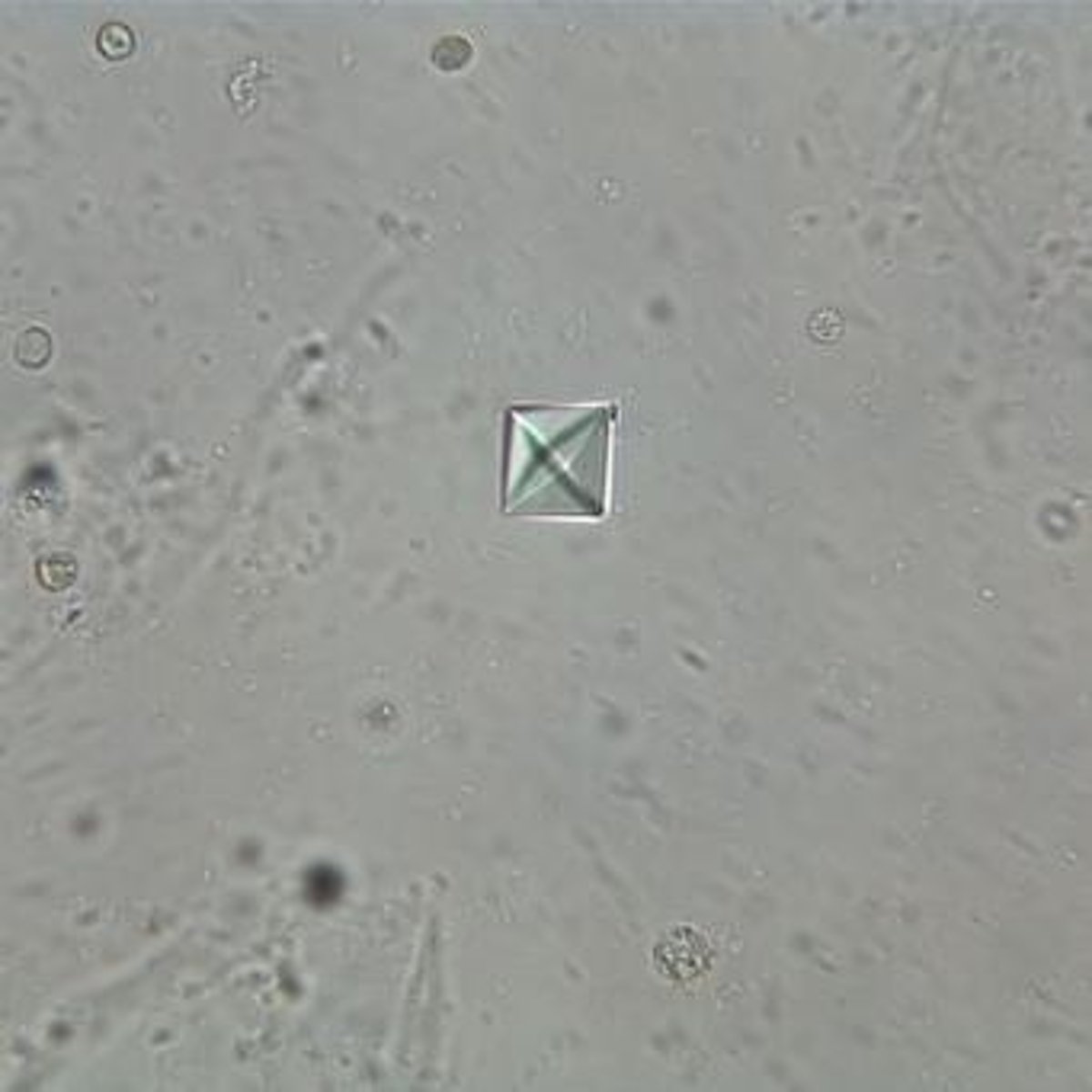 <p>Notched corners, found in acid pH, observed under Brightfield at 40x.</p>