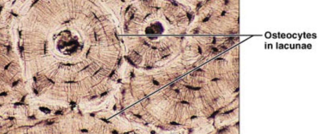 <p>hard calcified matrix with collagen fibers, osteocytes (bone cells) lie in lacunae, well vascularized</p>