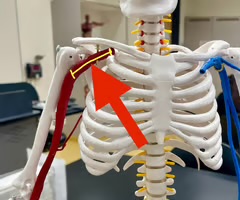 <p>Name the blood vessel.</p>