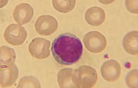 <p>nucleus fills most of the cell. important role in the immune system.</p>