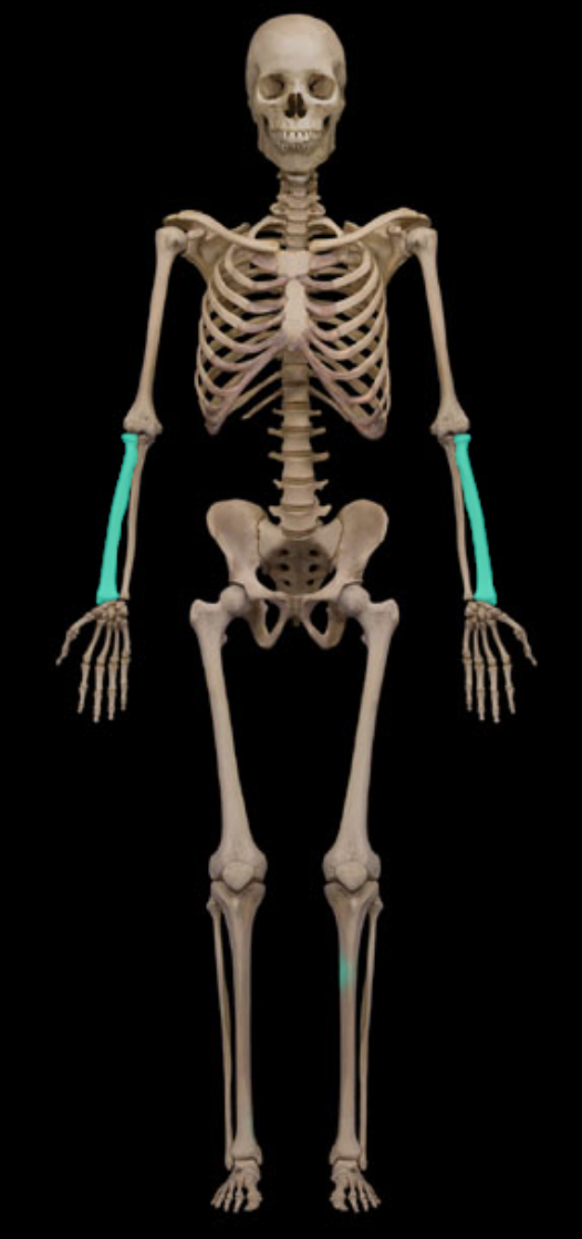 <p>Long thin bone in the forearm</p>