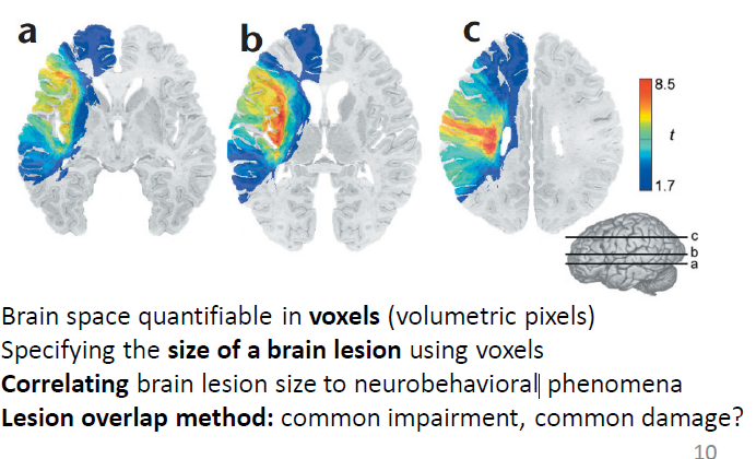 <p>common impairment, common damage? </p><p>create a heat map and overlap all the brain images to see if there is an overlap in where the legion is and the damage is</p><ul><li><p>can show where multiple places may be impacted and find the common one to see the core cause</p></li></ul><p></p>