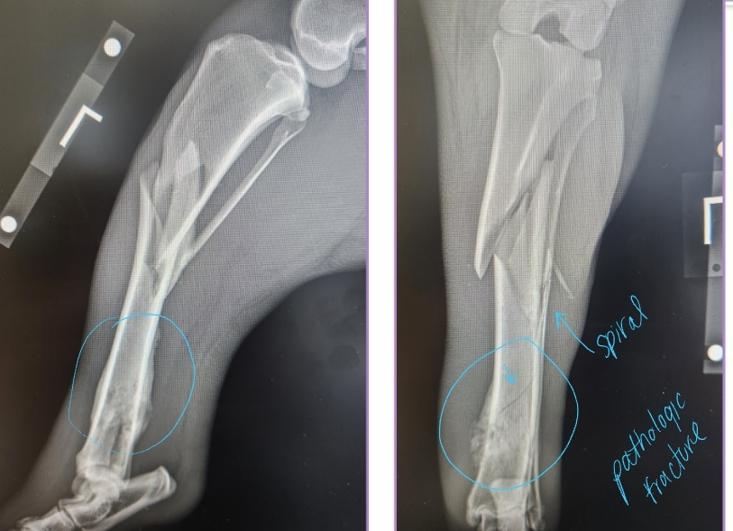 <ul><li><p><span style="background-color: transparent;"><strong><span>Et: </span></strong><u><span>Osteosarcoma</span></u><span>, Chondrosarcoma</span></span></p></li></ul><ul><li><p><span style="background-color: transparent;"><strong><span>Cs: </span></strong></span><span style="background-color: transparent; color: red;"><strong><span>Lameness, Muscle atrophy, Bone swelling</span></strong></span></p></li></ul><ul><li><p><span style="background-color: transparent;"><strong><span>Dt:</span></strong><span> </span><strong><span>Radiographs #1</span></strong><span>, CT, Bone biopsy </span></span></p><ul><li><p><span style="background-color: transparent;"><span>Osteolysis, Osteoproliferation, Soft tissue swelling</span></span></p></li><li><p><span style="background-color: transparent; color: red;"><strong><span>“Away from the elbow, toward the knee”</span></strong></span></p></li><li><p><span style="background-color: transparent; color: red;"><span>proximal humerus, distal radius/ulna & distal femur, proximal tibia</span></span></p></li></ul></li></ul><ul><li><p><span style="background-color: transparent;"><strong><span>Tx: </span></strong></span></p><ul><li><p><span style="background-color: transparent;"><strong><span>Amputation: </span></strong><span>Eliminates pain, MST </span><u><span>6 months</span></u></span></p></li><li><p><span style="background-color: transparent;"><strong><span>Amputation + Chemo:</span></strong><span> Eliminates pain, MST </span><u><span>12 months</span></u></span></p></li><li><p><span style="background-color: transparent;"><strong><span>Primary Stabilization + Chemo: </span></strong><span>Allows mobility, MST </span><u><span>12 months</span></u></span></p></li></ul></li><li><p>Chemo adds extra time of survival!!</p></li></ul><p></p>