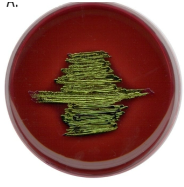 <p>Selects for Gram - species</p><p>Differentiates lactose fermenters with lactose fermenters being purple-black and non lactose fermenters being pink</p><p>Citrobacter and Enterobacter are further differentiated with citrobacter and E. coli creating a green metallic sheen</p>
