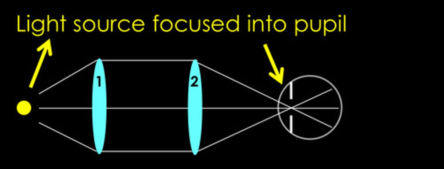 <p>In a Maxwellian view, where is the light source imaged?</p>
