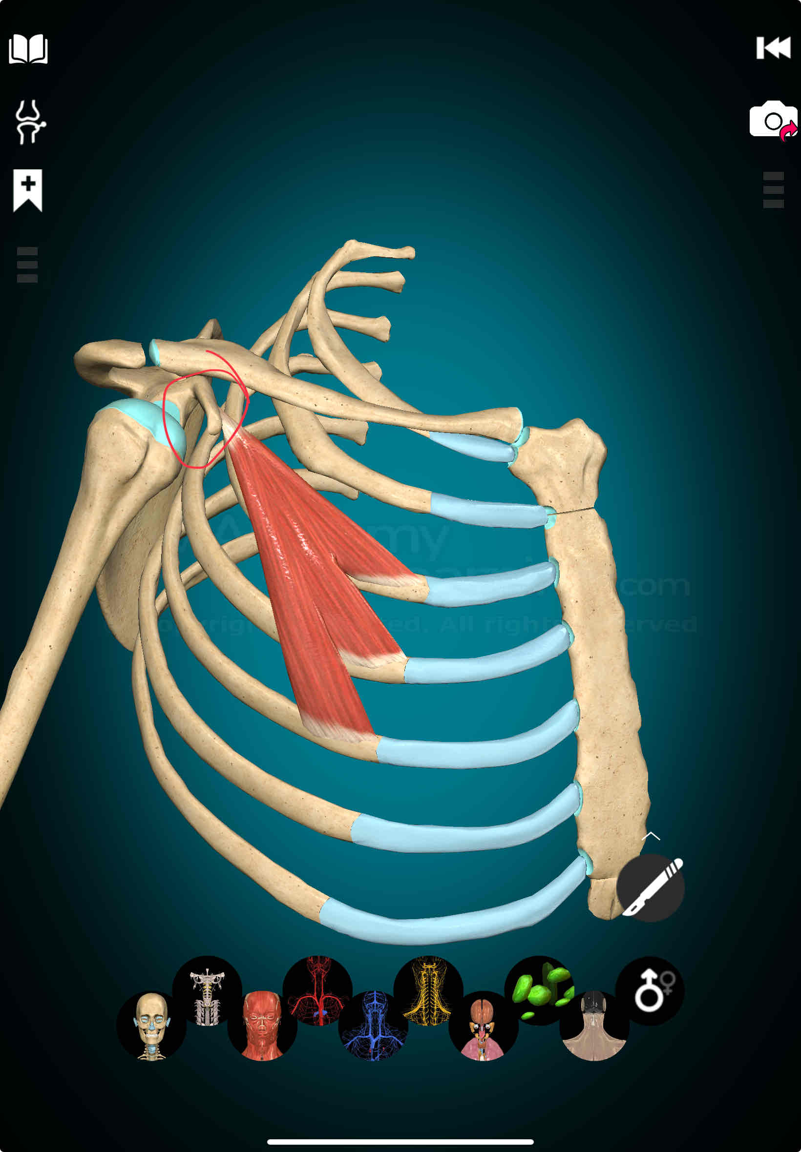 <p>Pectoralis Minor Insertion</p>