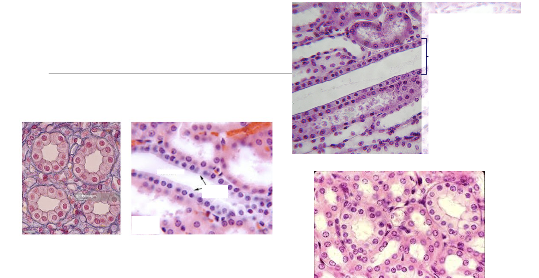 <p>What type of epithelial tissue?</p>
