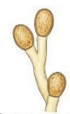 <p>“flagellated spore” fungi</p>