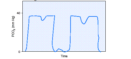 <p>During shift report, the day shift respiratory therapist informs the night shift respiratory therapist about a freshly postoperative patient who is receiving full support via mechanical ventilation. At the time of the last patient-ventilator system check the patient had not awaken from anesthesia. During first round on the day shift the respiratory therapist notes the capnography shown in the figure. The most appropriate action to take would be to do which of the following?</p>