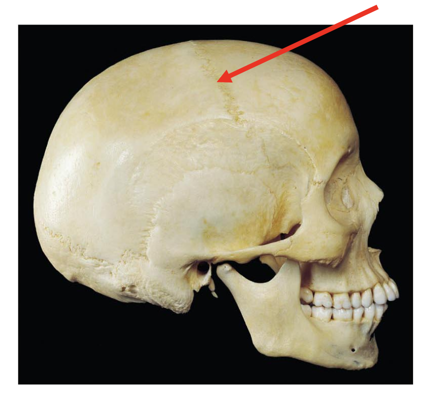 <p>The suture that the red arrow is pointing to is known as the ____ suture and a suture is a type of ____ joint.</p><p></p><p>A. lambdoid, fibrous</p><p>B. Coronal, fibrous</p><p>C. Squamous, cartiilaginous</p><p>D. Sagittal, synovial</p>