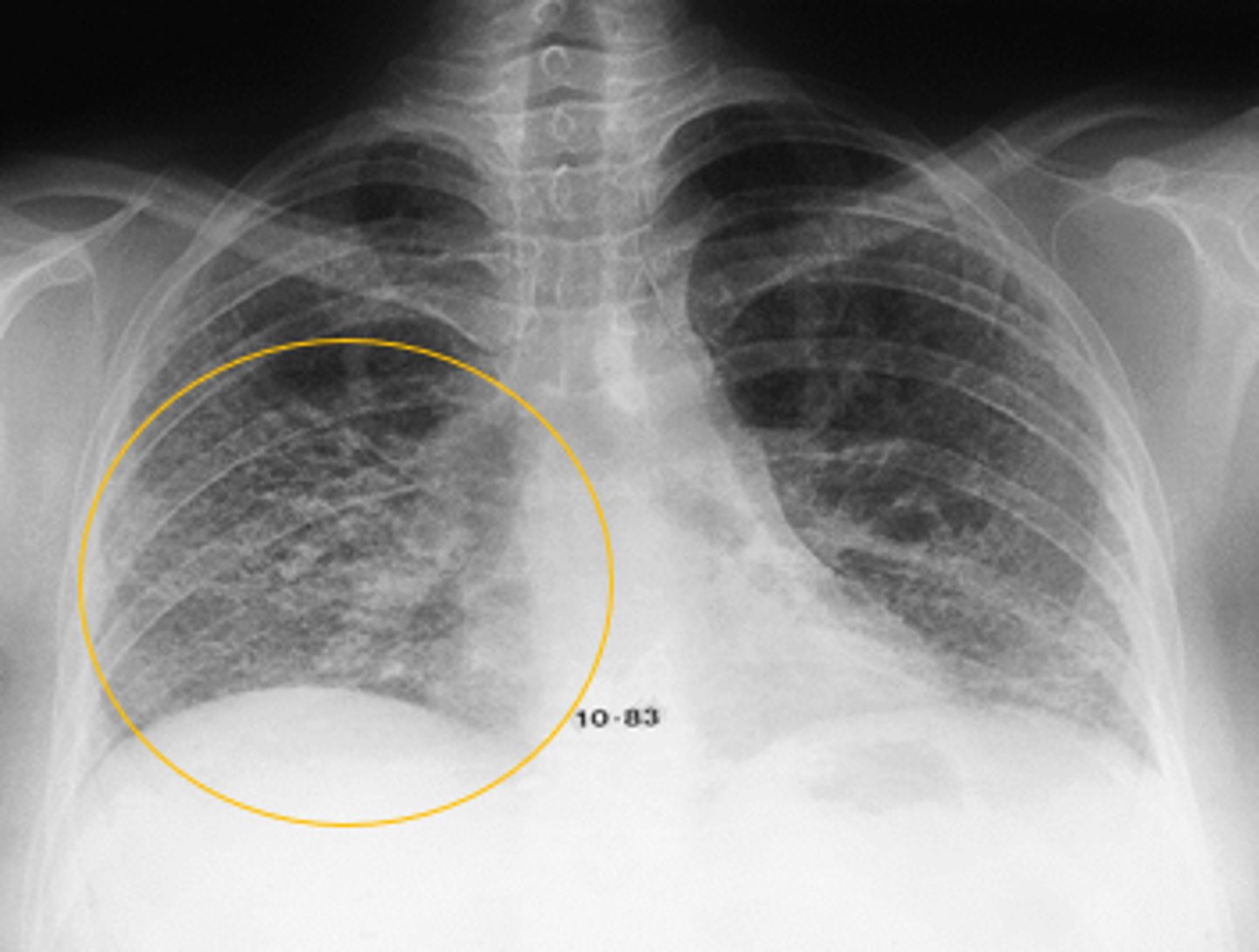 <p>Interpretation?</p>