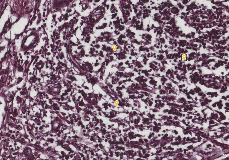 <p>identify area of histological slide, type of CT, and identify structures</p>