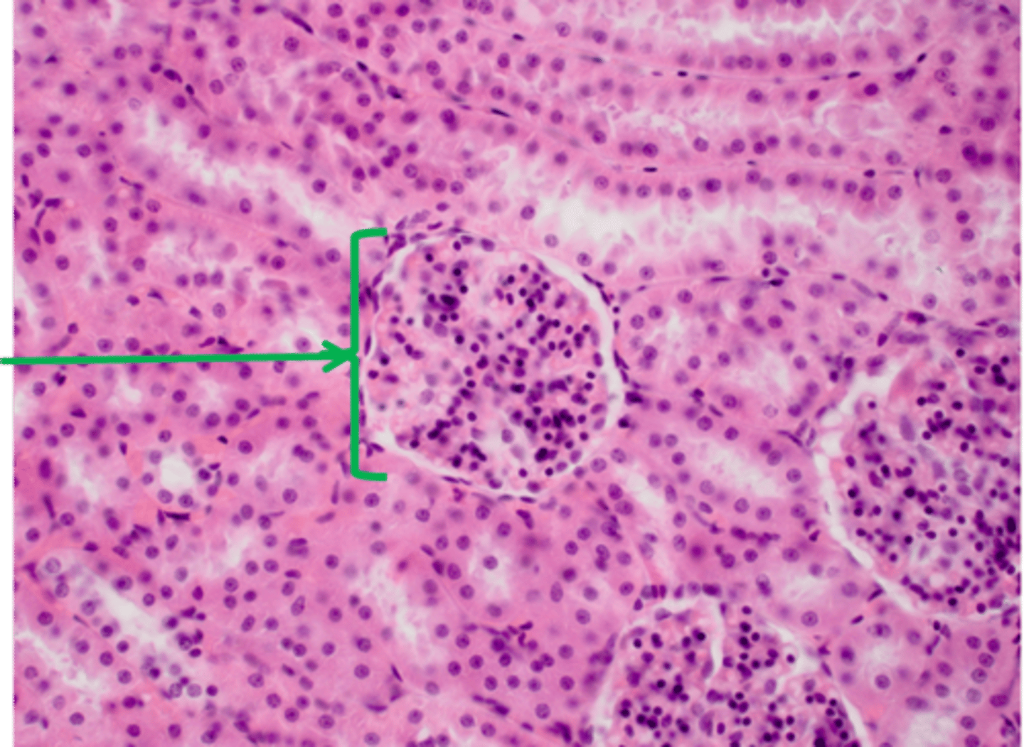 <p>Glomerulus and Bowman's capsule so the cortex of the kidney</p>