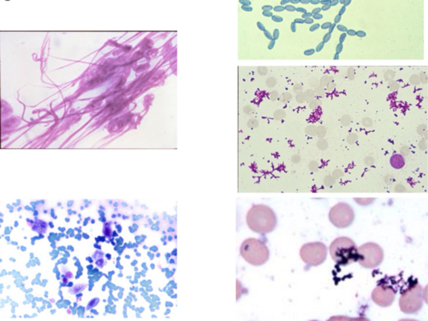 <p>The following is an example of what?</p>