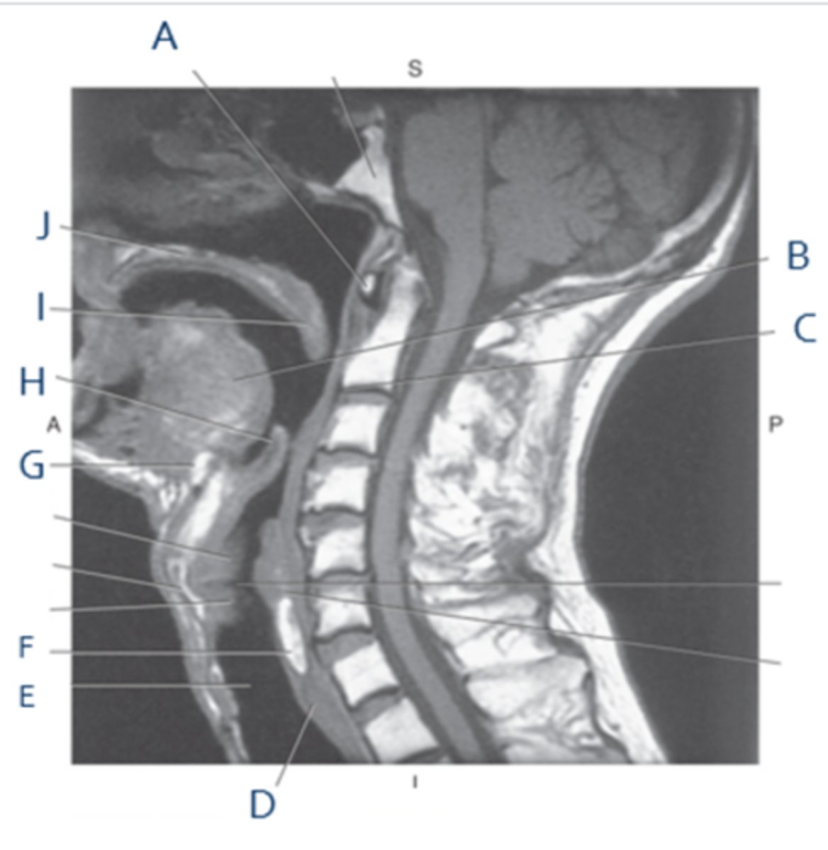 <p>Label F</p>