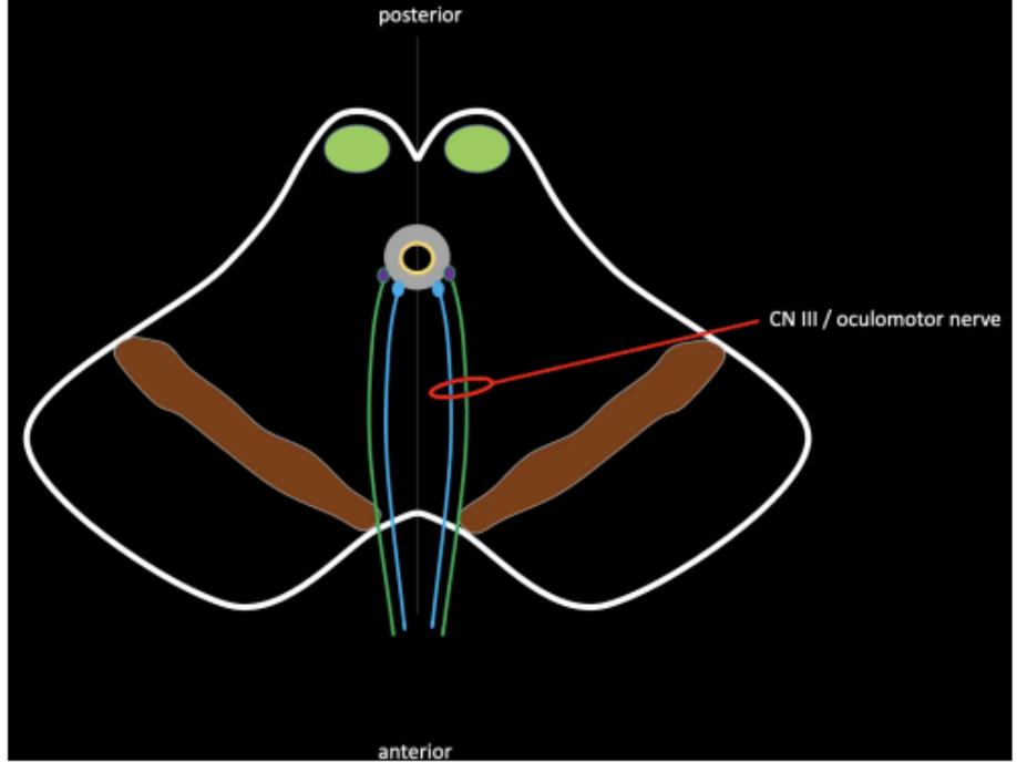 <p>interpeduncular fossa</p>