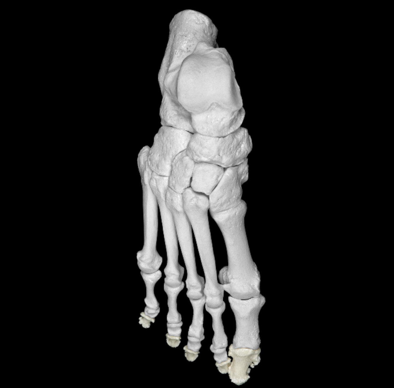 <p>most distal phalanges of foot </p><p>all digits </p>