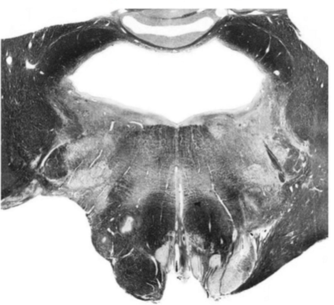 <p>ID the brainstem level</p>