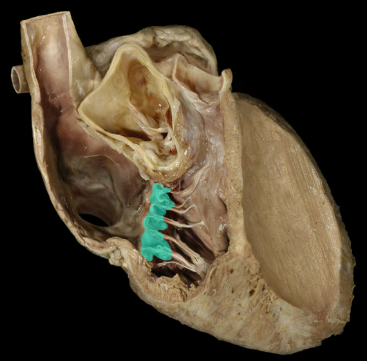 <p>Tricuspid valve</p>