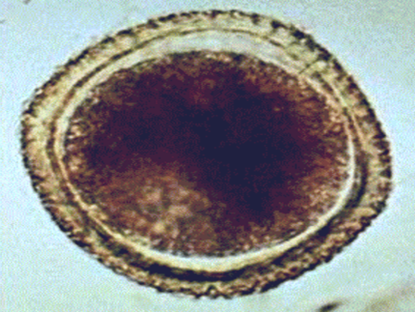 <p>This was found in a stool sample of a coughing puppy with diarrhea. What is it?</p>