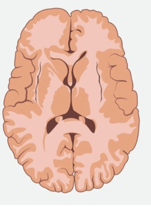 <p>Name this plane</p>