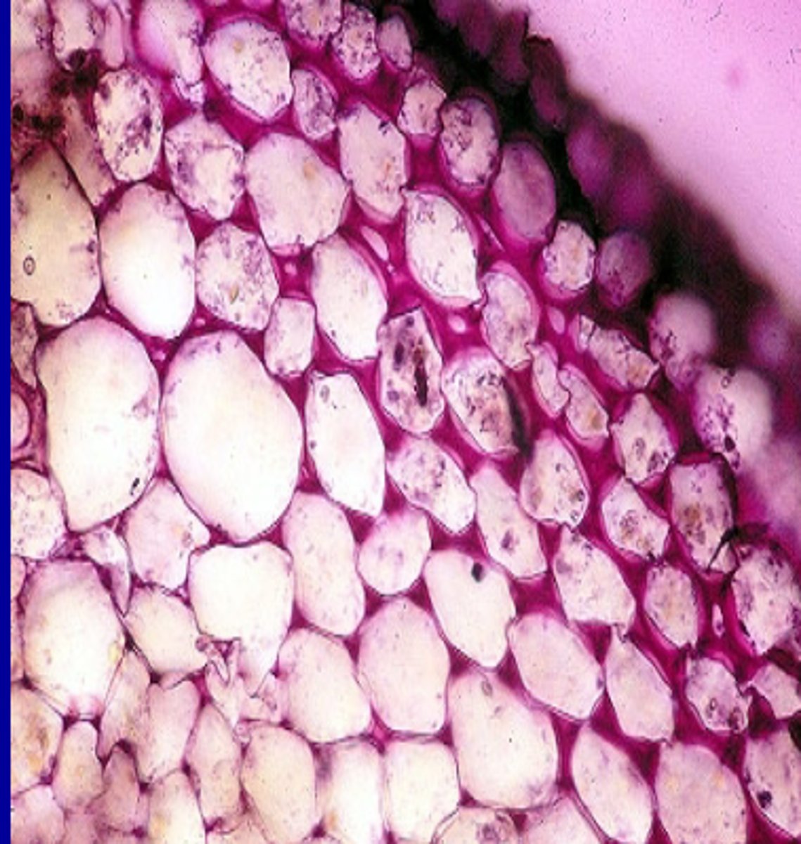 <p>-Part of the ground tissue system</p><p>-Also associated with phloem</p><p>-Live at maturity</p><p>-Unevenly thickened primary cell wall</p><p>-Common in the ground tissues of stems and petioles</p><p>-Function is flexible support which allows for plant growth</p>