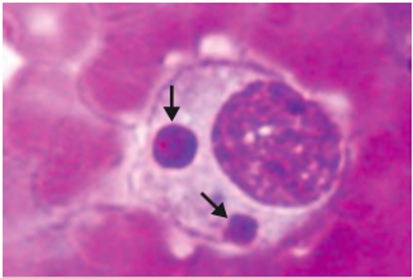 <p>basophilic, irregularly shaped granular, cytoplasmic inclusions found in leukocytes in an infectious disease called ehrlichiosis.</p>