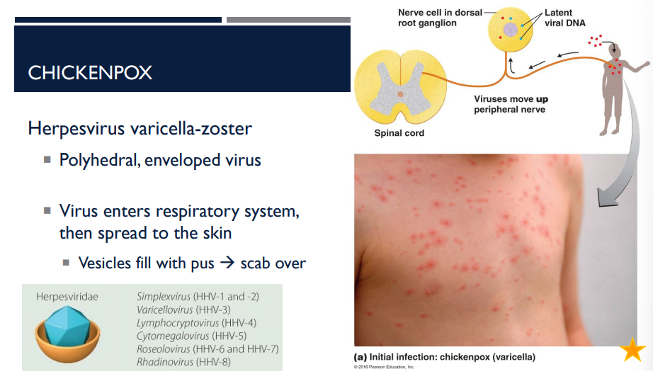<p>This virus enters the respiratory system then spreads to the skin. The vesicles fill with pus and then over time, they rupture and scab over. What disease am I describing? What virus is it caused by?</p>