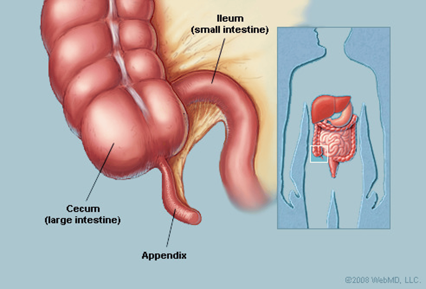 <p>vestigial; appendicitis</p>