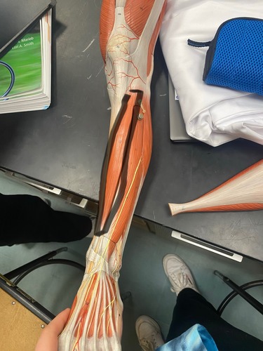 <p>Foot dorsiflexion and inversion</p>