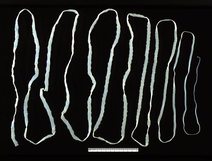 <p>Tape worms</p>