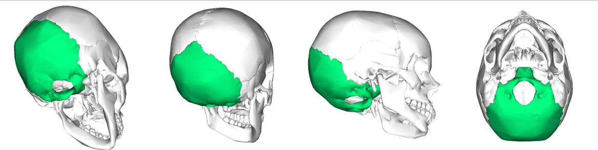 <p>Can you name what each view is of the occipital bone of the cranium?</p>