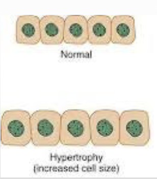 <p><span>Increase in the size of cells resulting in increase in size of the organ</span></p>