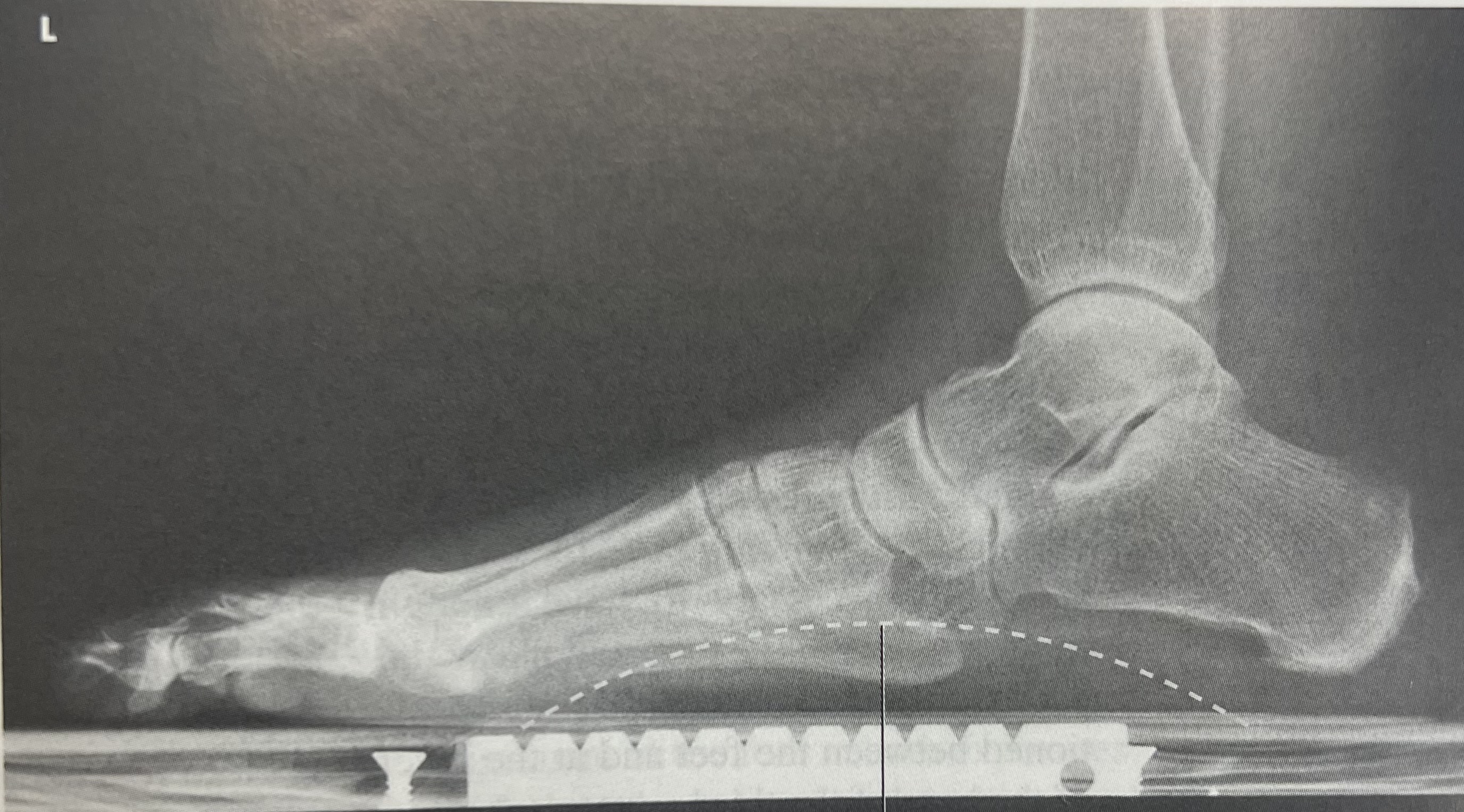 <p>identify part <strong>position</strong> of the image </p>