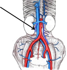 <p>Name this vein.</p>