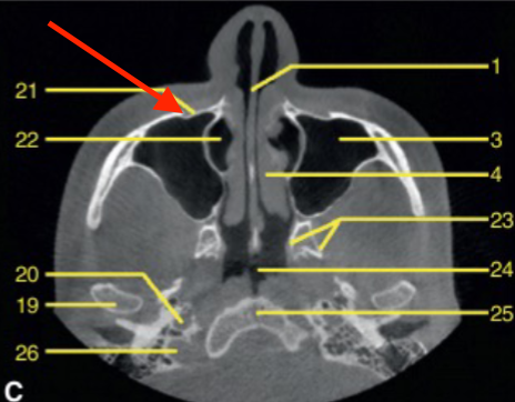 <p>identify structure </p>