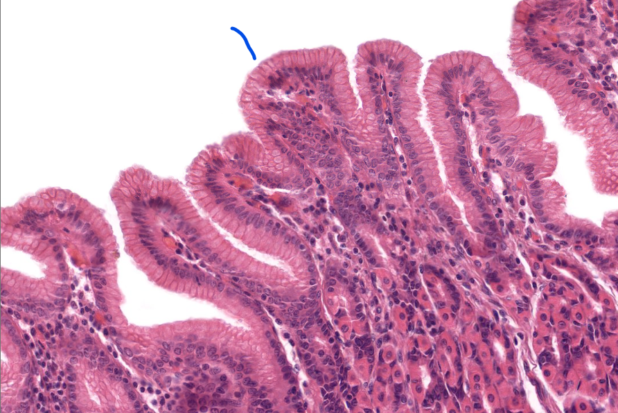 <p>tissue type</p>