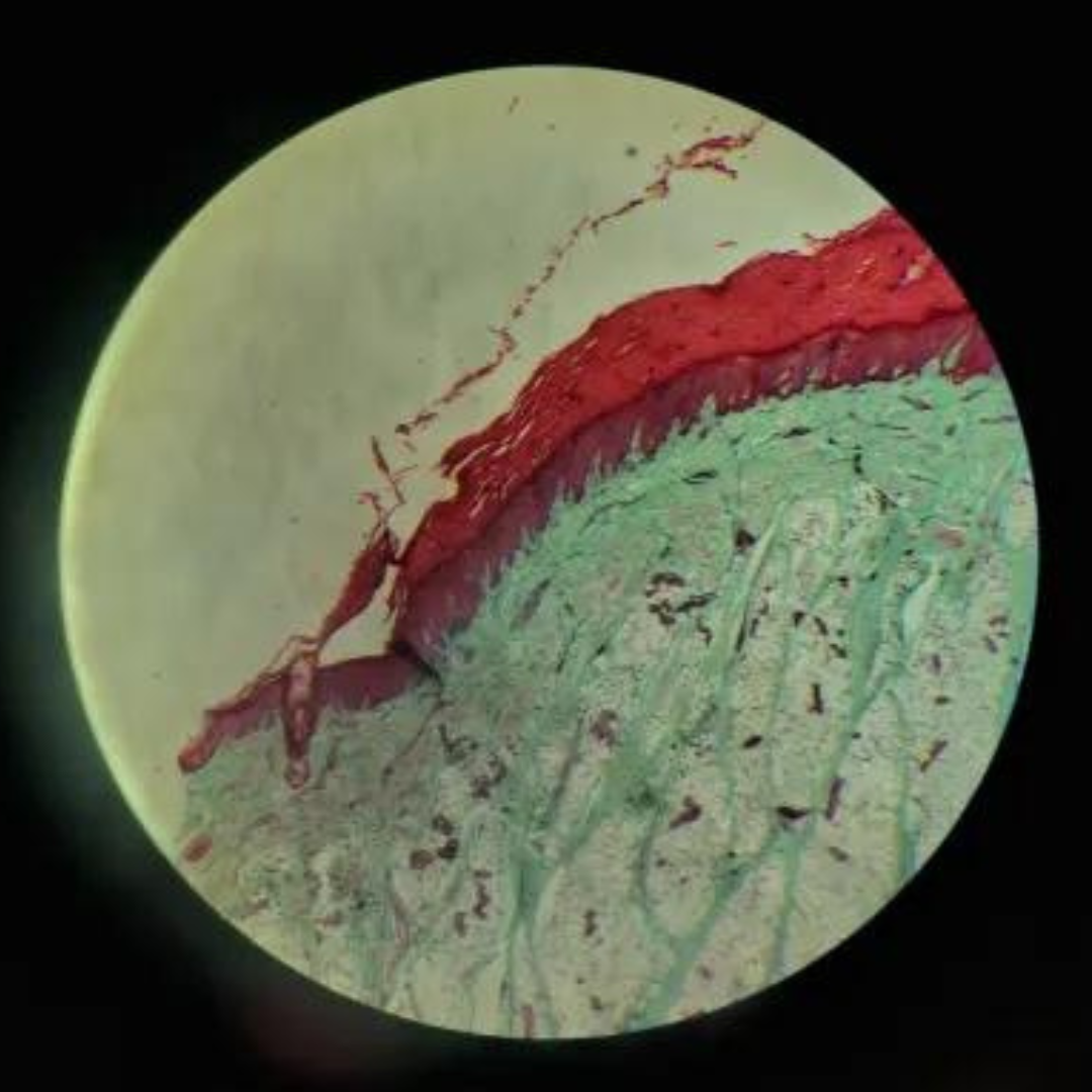 term image