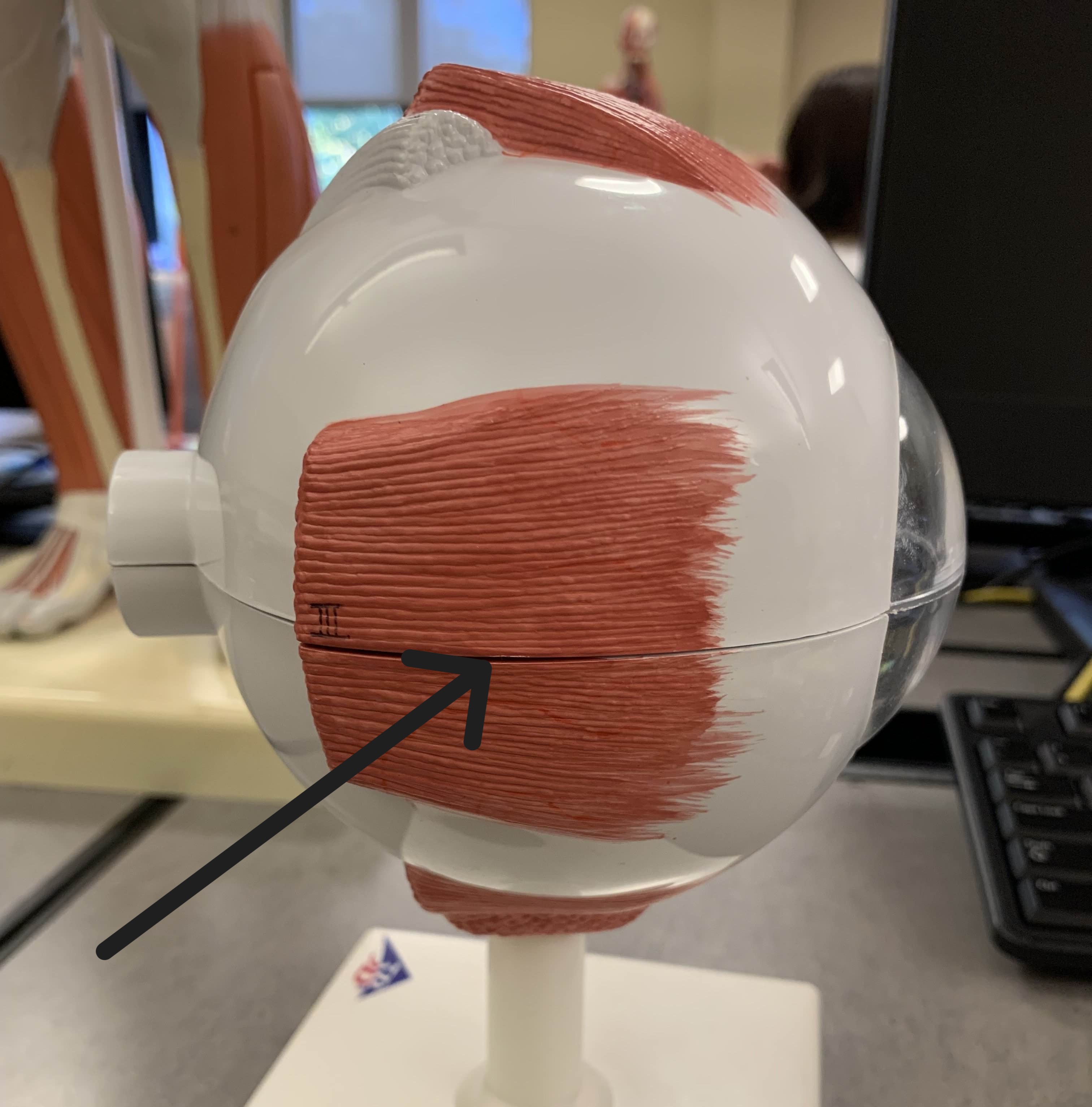 <p>Which muscle of the eye is:</p><ul><li><p>Located medial to the pupil</p></li><li><p>Action: eye looks medial</p></li><li><p>Nerve: <span style="color: yellow;">CN III</span></p></li></ul><p></p>