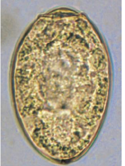 <p>100 × 50 um</p><p>operculum</p>