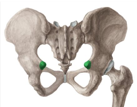 <p>inferior end of greater sciatic notch </p>
