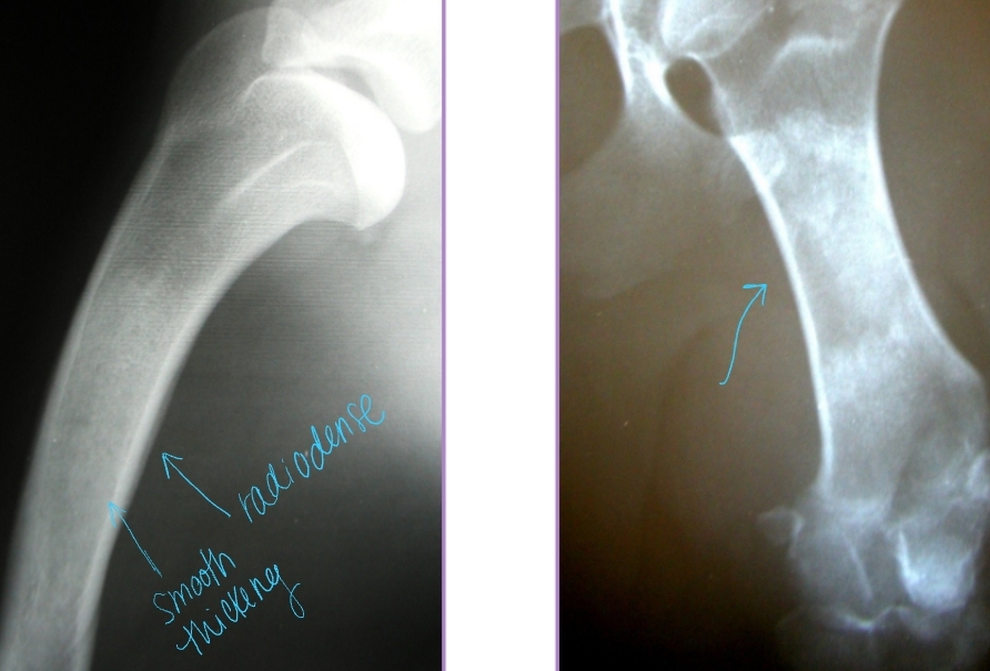 <p><span style="background-color: transparent;"><strong><span>Panosteitis</span></strong></span></p>