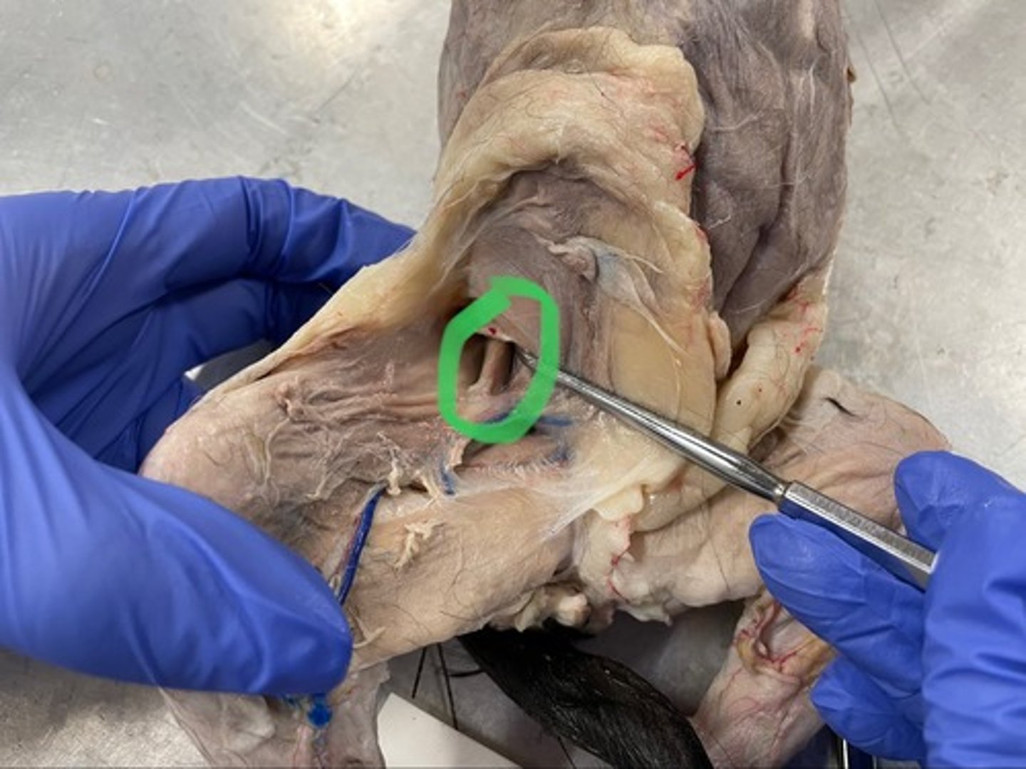 <p>O: iliac fossa of ilium; vertebrae T12-L3</p><p>I: lesser trochanter of femur</p><p>A: flex hip</p>