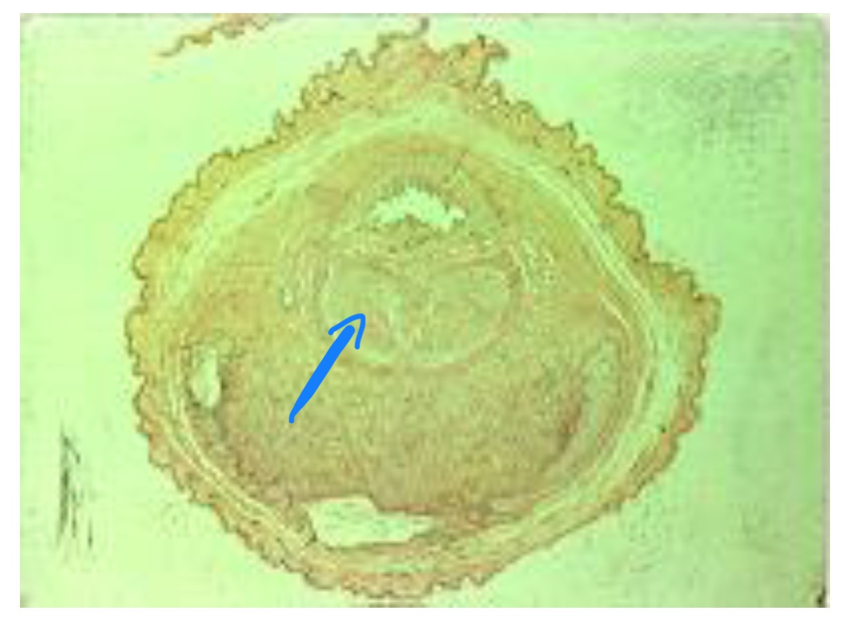 term image