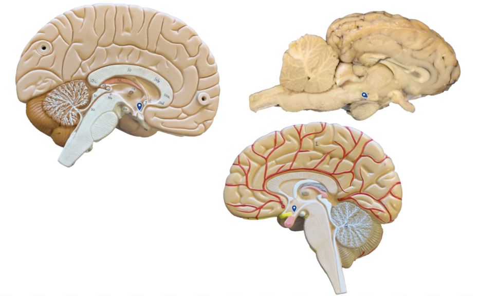 <p>What structure is the arrow pointing to?</p>