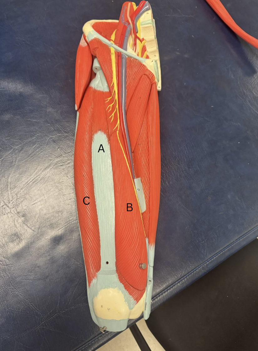 <p>Label the quad muscles</p>