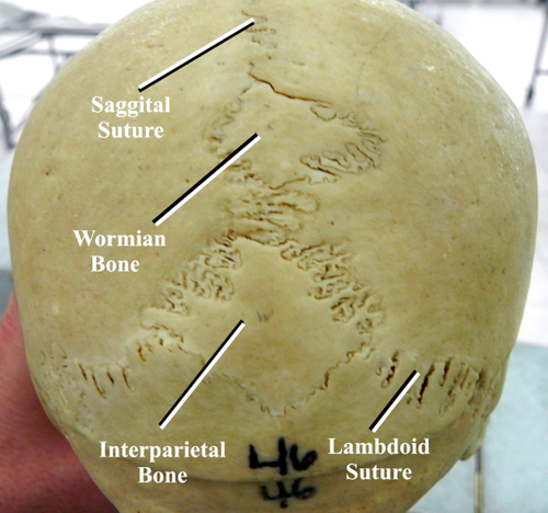 <p>Small, irregular bones that form within the sutures (joints) of the skull. </p><p>Function: Fill gaps and add stability between cranial bones. </p><p>Examples: tiny bones along the lambdoid suture (between parietal &amp; occipital bones)</p>